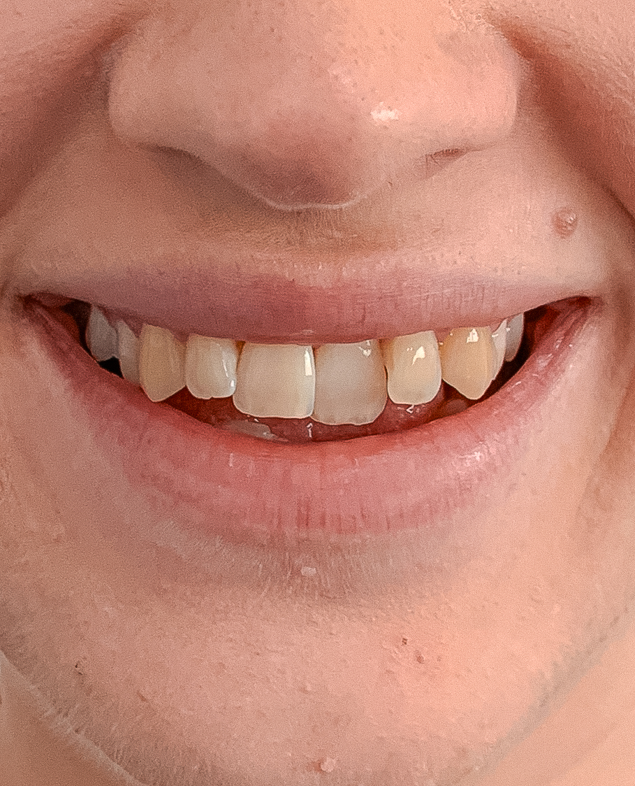 Before image